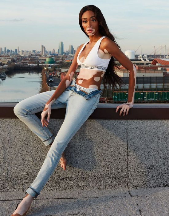 欧美美女名模Winnie Harlow Remix杂志封面大片